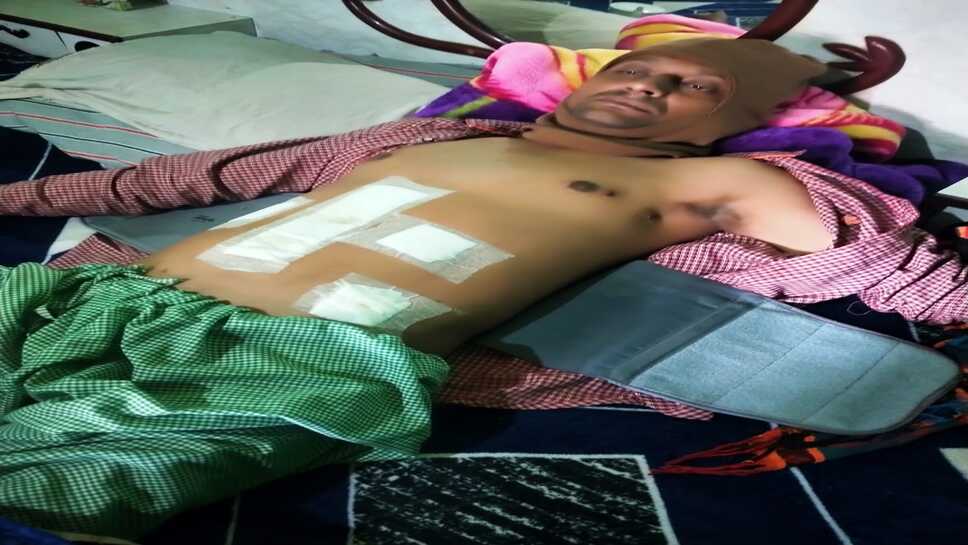 शराब पीने से मना करने पर युवक पर चाकूूओं से हमला, 17 दिन बाद भी आरोपी पुलिस गिरफ्त से बाहर