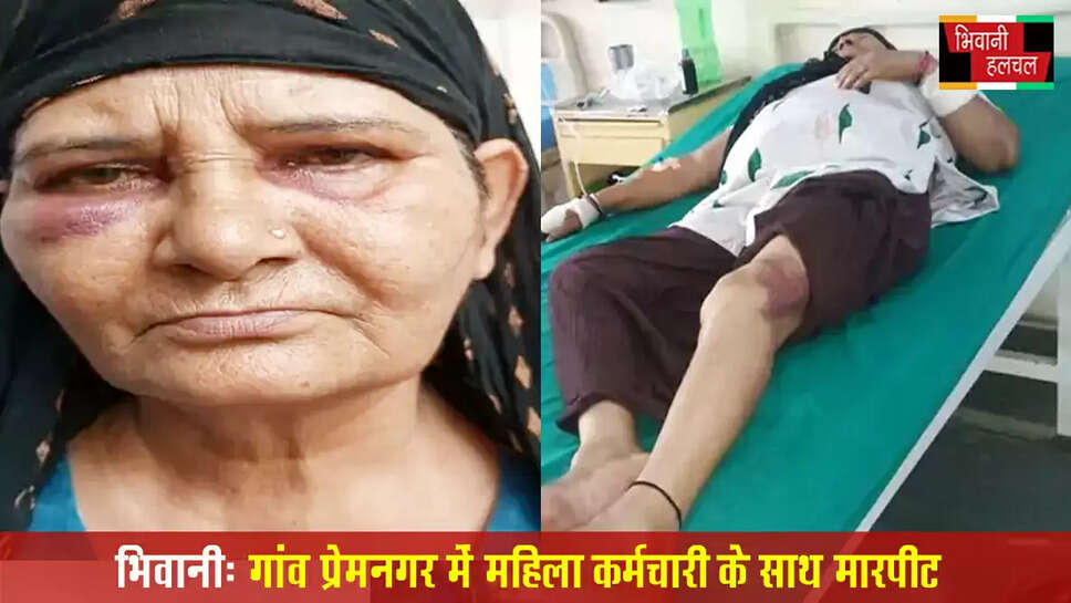 भिवानी में महिला कर्मचारी से मारपीट:पशु अस्पताल में ड्यूटी के लिए पहुंची थी&nbsp;