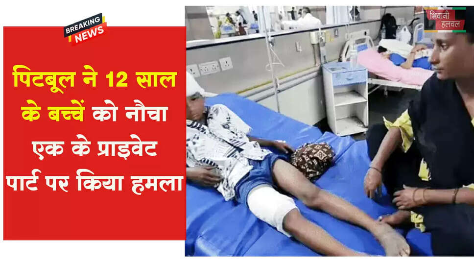 पिटबुल ने 12 साल के बच्चे को नोचा&nbsp;